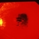 Central Pigment Changes