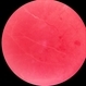 Diabetic Retinopathy Diabetic Retinopathy
