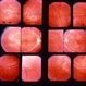Fleck Retinopathy Fundus Flavimaculatus Fleck Retinopathy Fundus Flavimaculatus