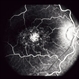 Normal Retina