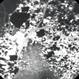 Cavernous Hemangioma Cavernous Hemangioma