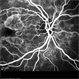 Stargardt's Disease Stargardt's Disease