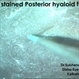 TA Stained Posterior Hyaloid Face TA Stained Posterior Hyaloid Face
