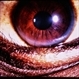 Wilson's Disease Wilson's Disease