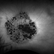 Mucopolysaccharidosis Type III (Sanfilippo syndrome) Mucopolysaccharidosis Type III (Sanfilippo syndrome)