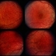 Fundus albipunctatus Fundus albipunctatus