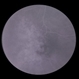 Hemangioma