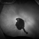 Fundus Autofluorescence of Closed Funnel Retinal Detachment Fundus Autofluorescence of Closed Funnel Retinal Detachment