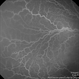 Vascular Abnormalities in Congenital Heart Disease Vascular Abnormalities in Congenital Heart Disease