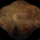Active Laser Modified Proliferative Diabetic Retinopathy Active Laser Modified Proliferative Diabetic Retinopathy