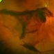 T-Rex Hemorrhage T-Rex Hemorrhage