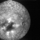 AMPPE Fluorescein Angiogram late AMPPE Fluorescein Angiogram late