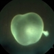 Intravitreal Cysticercosis Intravitreal Cysticercosis