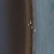 Magnification of the Eye Wall from an Enucleated Eye Magnification of the Eye Wall from an Enucleated Eye