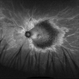 Rod cone dystrophy  autofluorescence Rod cone dystrophy  autofluorescence