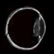 Whole Eye OCT
