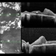 Diabetic Macular Edema Diabetic Macular Edema