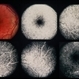 Fundus albipunctatus Fundus albipunctatus