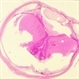Toxoplasmosis Toxoplasmosis