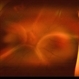 Serous Retinal Detachment Serous Retinal Detachment