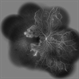 Idiopathic Occlusive Retinal Vasculitis (Late Stage) Idiopathic Occlusive Retinal Vasculitis (Late Stage)