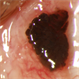 Pigmented Conjuctival Lesion