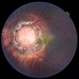 Morning Glory Disc Anomaly Morning Glory Disc Anomaly