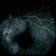 Vitreous Traction on Disc / PVD Vitreous Traction on Disc / PVD