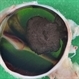 Choroidal Melanoma