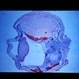 Slide 3-16