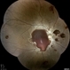 Anemic Retinopathy Related Retinal Hemorrhages Anemic Retinopathy Related Retinal Hemorrhages