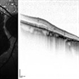 Geographic Atrophy 2nd to Central areolar choroidal dystrophy Geographic Atrophy 2nd to Central areolar choroidal dystrophy