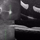 Macular Hole RD
