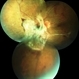 FLORID Type PDR OS FLORID Type PDR OS