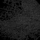 Branch Retinal Vein Occlusion Branch Retinal Vein Occlusion