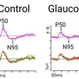 Representative Pattern Electroretinography Responses