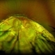 Retina and Choroid Coloboma in a 3-Year-Old Boy Retina and Choroid Coloboma in a 3-Year-Old Boy