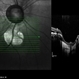 Coloboma of Disc & Choroid Coloboma of Disc & Choroid