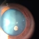 Universe within the eye Universe within the eye
