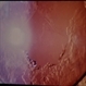 Lens After YAG Capsulotomy