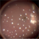 Seedlings of Fungal Endophthalmitis Seedlings of Fungal Endophthalmitis