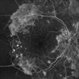PROLIFERATIVE DIABETIC RETINOPATHY PROLIFERATIVE DIABETIC RETINOPATHY