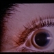 Wilson's Disease Wilson's Disease