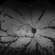 Autofluorescence Stage 3 Vogt-Koyanagi-Harada (VKH) Disease