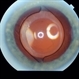 Multifocal PC IOL