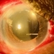 Scleral Fixated IOL Scleral Fixated IOL