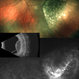 Choroidal Mass