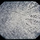 Ophthalmic Artery Occlusion / RP-Like