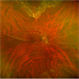 Color Photograph of a Full Thickness Macular Fold Color Photograph of a Full Thickness Macular Fold