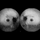 Retinitis Pigmentosa Retinitis Pigmentosa